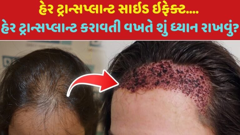 હેર ટ્રાન્સપ્લાન્ટ સાઇડ ઇફેક્ટ અને હેર ટ્રાન્સપ્લાન્ટ કરાવતી વખતે શું શું ધ્યાન રાખવું?