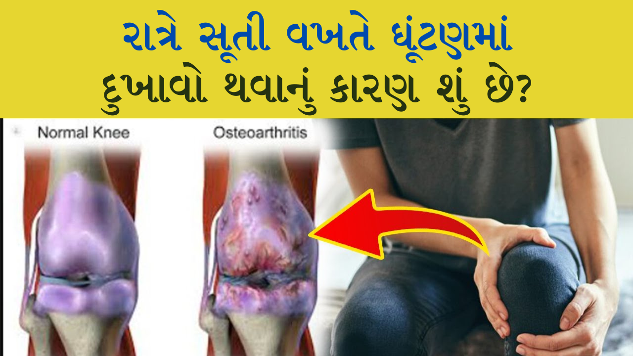 રાત્રે સૂતી વખતે ઘૂંટણમાં દુખાવો થવાનું કારણ શું છે? રાત્રે સૂતી વખતે ઘૂંટણમાં દુખાવો થવાનું કારણ શું છે?